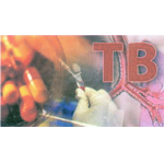 Ancaman TB -MBR